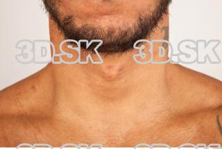 Neck texture of Ron 0003